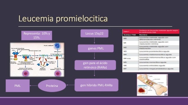 leucemia promielocitica aguda